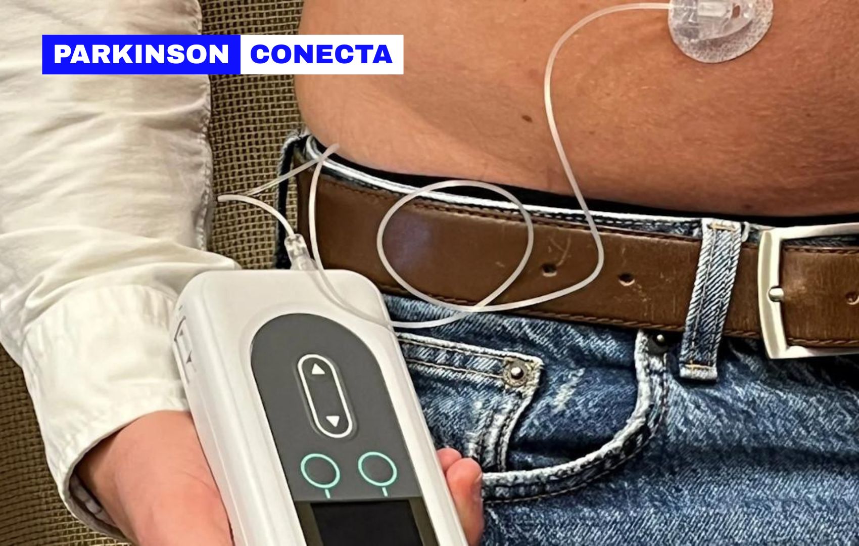 O tratamento do Parkinson est� avan�ando: conhe�a a levodopa de infus�o cont�nua!