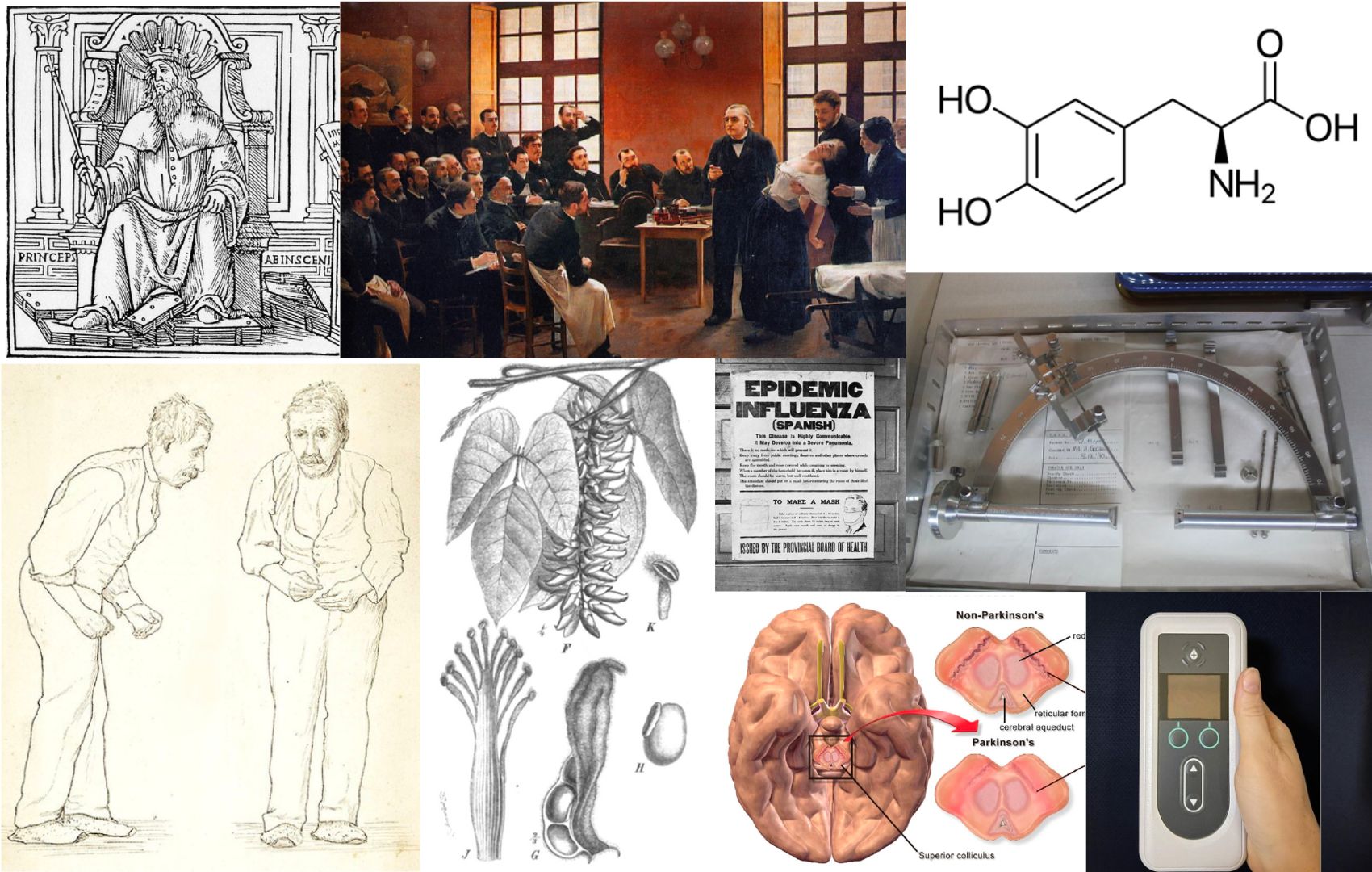 Linha do tempo: os momentos que marcaram a hist�ria da Doen�a de Parkinson!