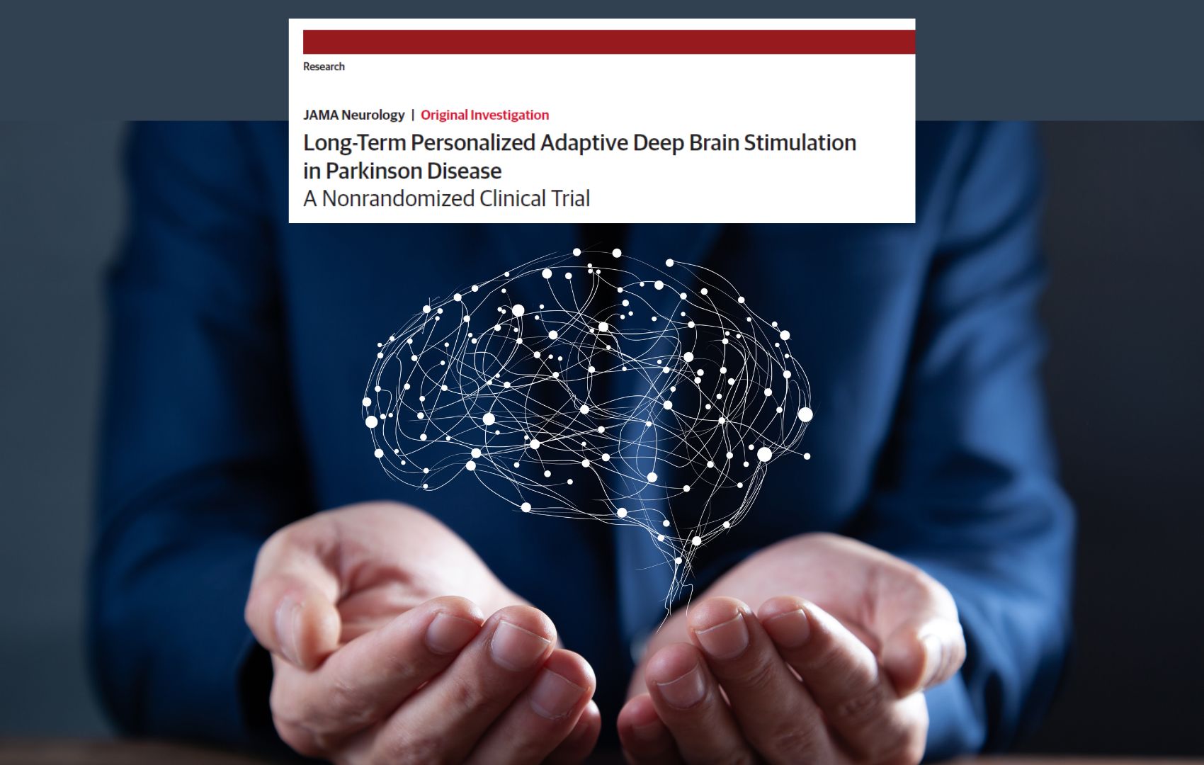 DBS adaptativo: tecnologia que acompanha o ritmo do c�rebro